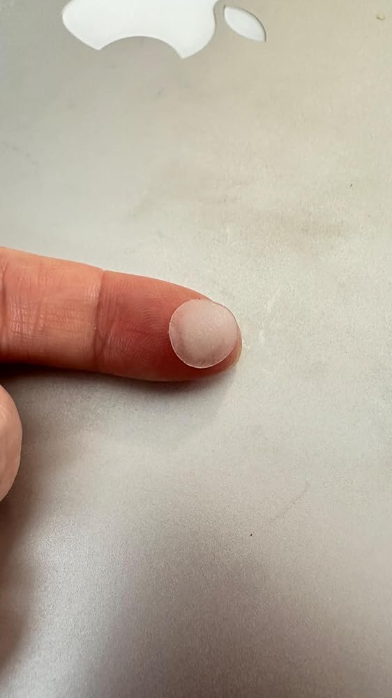 Daolyo Pimple Patches: My Overnight Acne Savior