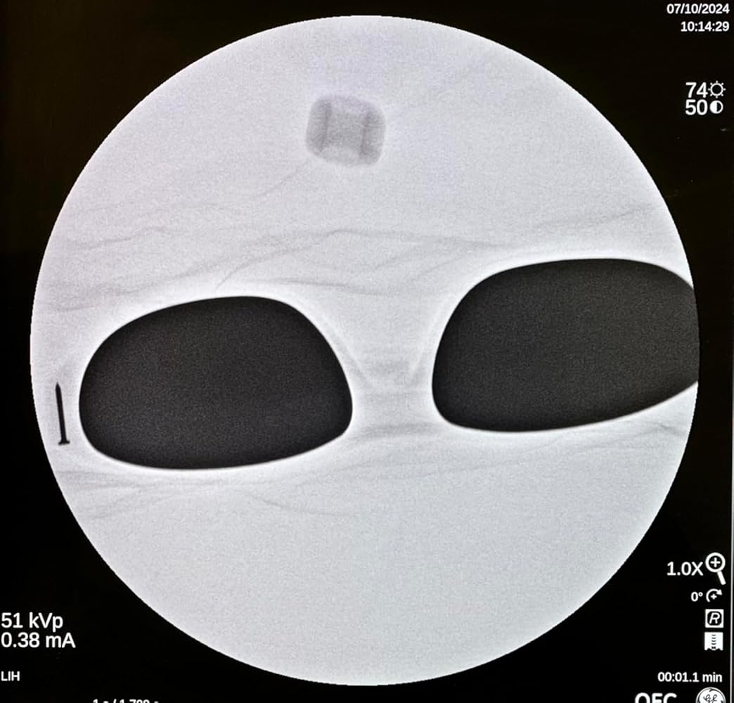 Schott SF-6 HT X-Ray Protective Lead Glasses, Black Maxx Wrap Safety Frame, 62x18x145mm