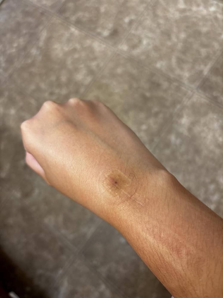 Bio-Oil Skincare Body Oil Serum, Face and Body Moisturizer with Vitamin E &amp; A, for Scars, Stretch Marks, Sensitive Skin, All Skin Types, Dermatologist Recommended, Non-Comedogenic, 2 Oz